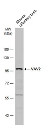 Anti-VAV2 antibody used in Western Blot (WB). GTX131451